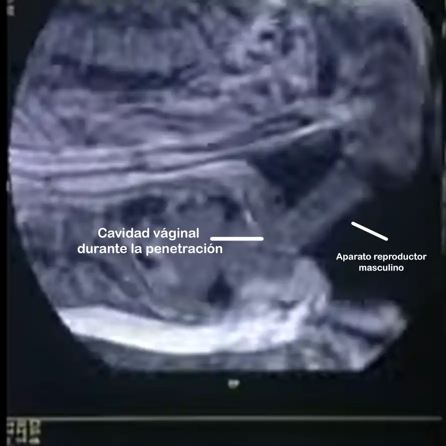 Representación gráfica del sexo con resonancia magnética que muestre el cuerpo femenino desde el centro, con zonas de calor marcadas en color (clítoris, útero, aparato reproductor masculino).