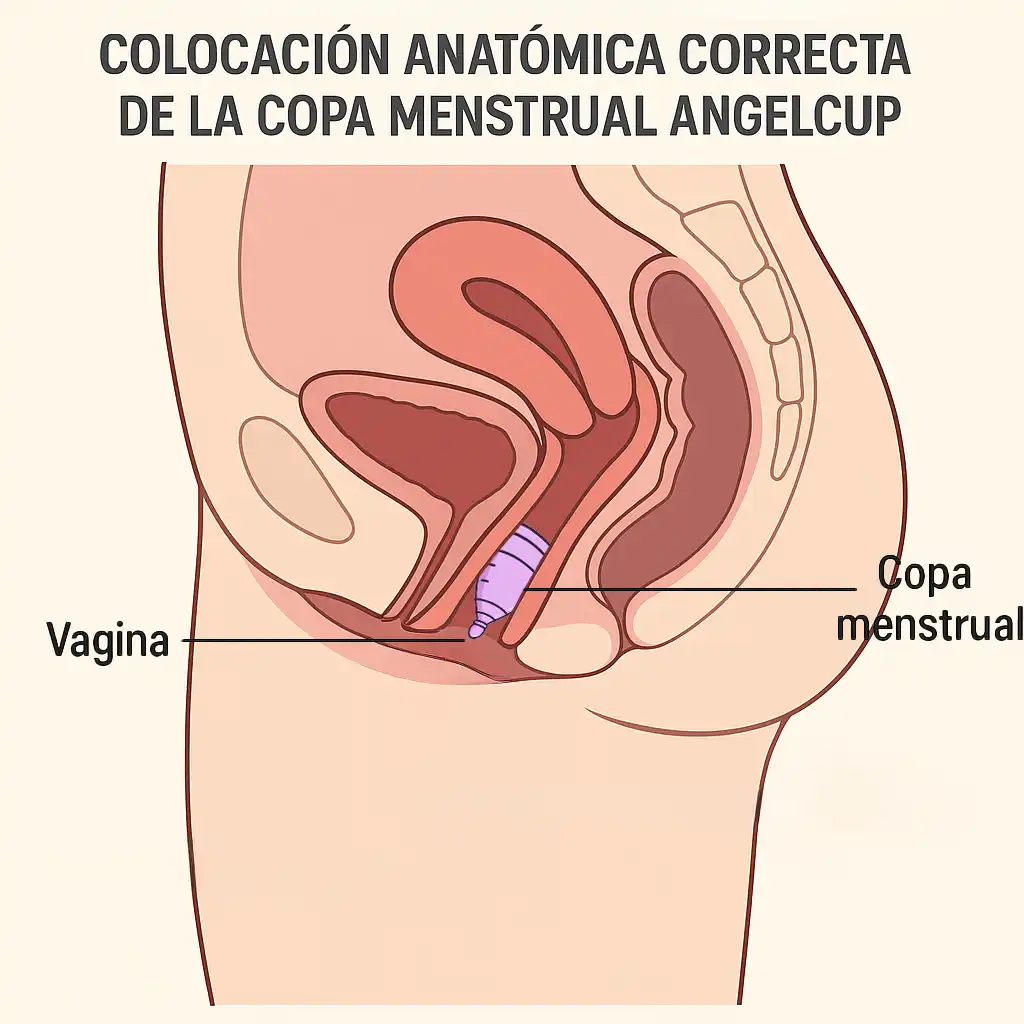 Ilustración de la colocación anatómica correcta de la copa menstrual Angelcup. El diagrama muestra la copa posicionada de forma baja en el canal vaginal, debajo del cérvix, para una protección segura y cómoda.